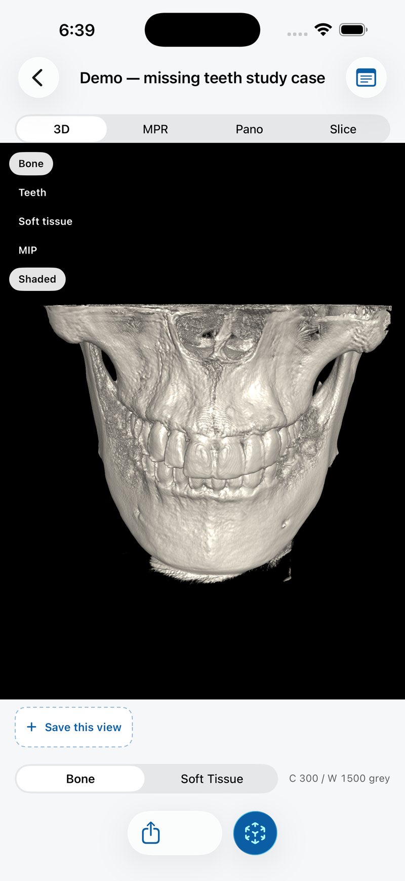 3D volume rendering